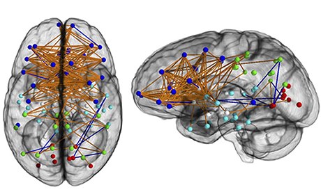 Connectome of female brain. Credit: National Academy of Sciences